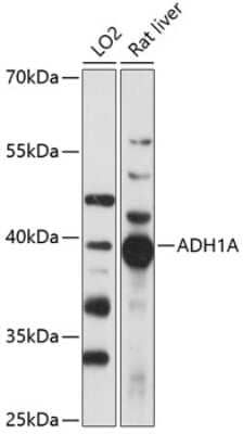 Western Blot: alcohol dehydrogenase AntibodyAzide and BSA Free [NBP2-92180]