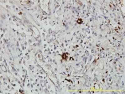 Immunohistochemistry-Paraffin: alpha 1-Acid Glycoprotein Antibody (2F9-1F10) [H00005004-M01]