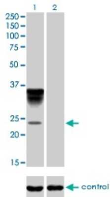 Western Blot: alpha 1-Acid Glycoprotein Antibody (2F9-1F10) [H00005004-M01]