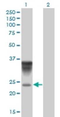 Western Blot: alpha 1-Acid Glycoprotein Antibody (2F9-1F10) [H00005004-M01]