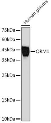 Western Blot: alpha 1-Acid Glycoprotein Antibody (9L2J6) [NBP3-15790]