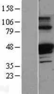 Western Blot: Serpin A1/alpha 1-Antitrypsin Overexpression Lysate [NBL1-15833]