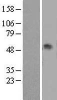 Western Blot: Serpin A1/alpha 1-Antitrypsin Overexpression Lysate [NBL1-15835]