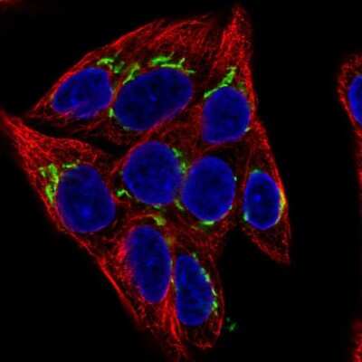 Immunocytochemistry/ Immunofluorescence: alpha 1 Mannosidase 1A Antibody [NBP2-37938]