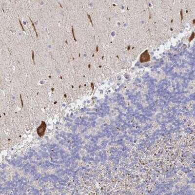 Immunohistochemistry: alpha 1 Mannosidase 1A Antibody [NBP2-37938]