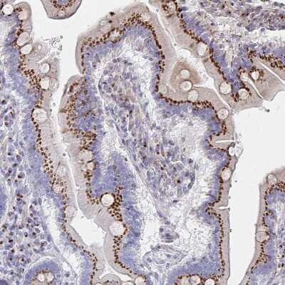 Immunohistochemistry-Paraffin: alpha 1 Mannosidase 1A Antibody [NBP2-37938]