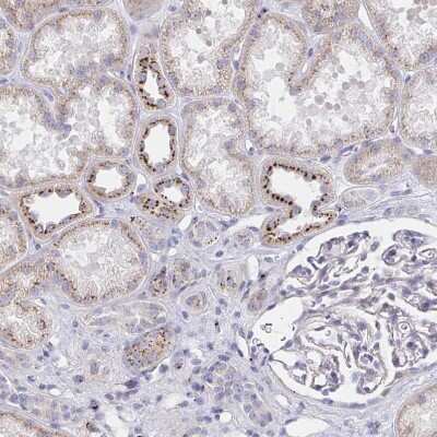 Immunohistochemistry-Paraffin: alpha 1 Mannosidase 1A Antibody [NBP2-37938]