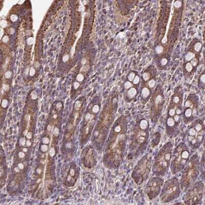 Immunohistochemistry-Paraffin: alpha 1 Mannosidase 1A Antibody [NBP2-38030]