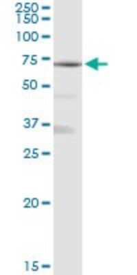 Western Blot: alpha 1 Mannosidase 1A Antibody [H00004121-D01P]