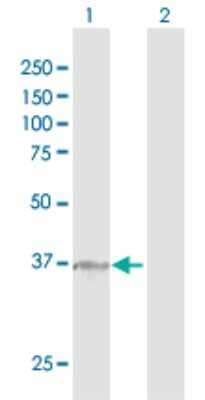Western Blot: alpha 1 Mannosidase 1A Antibody [H00004121-D01P]