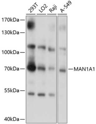 Western Blot: alpha 1 Mannosidase 1A AntibodyAzide and BSA Free [NBP2-92040]