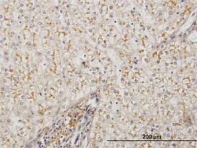 Immunohistochemistry-Paraffin: alpha 1-Microglobulin Antibody (3F1) [H00000259-M01]
