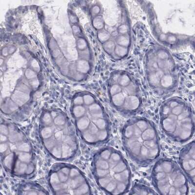 Immunohistochemistry-Paraffin: alpha 1-Microglobulin Antibody [NBP1-87958]