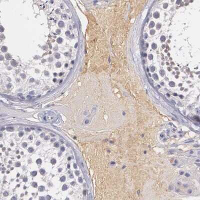 Immunohistochemistry-Paraffin: alpha 1-Microglobulin Antibody [NBP1-87958]