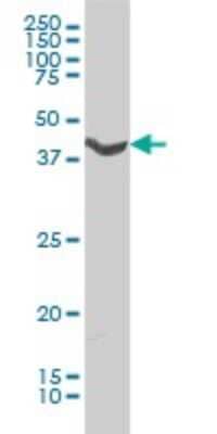 Western Blot: alpha-1A Adrenergic R/ADRA1A Antibody (4C7) [H00000148-M01]