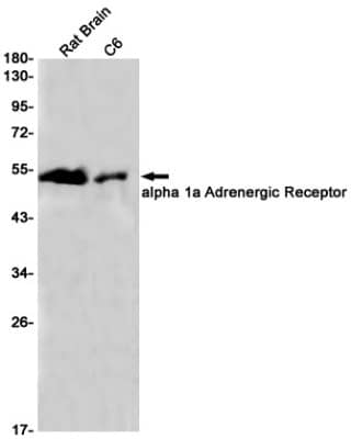 Western Blot: alpha-1A Adrenergic R/ADRA1A Antibody (S04-8B8) [NBP3-19566]