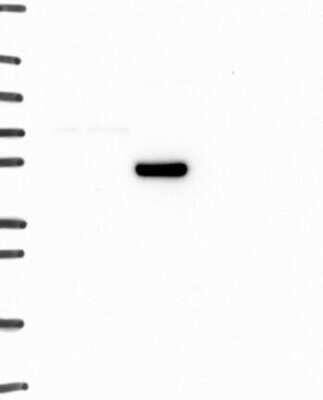 Western Blot: alpha-1A Adrenergic R/ADRA1A Antibody [NBP3-17211]