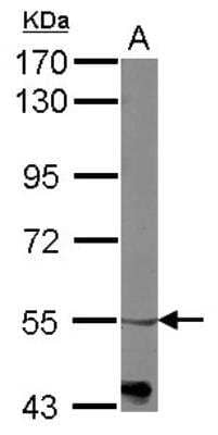 Western Blot: alpha-1B Adrenergic R/ADRA1B Antibody [NBP2-15351]