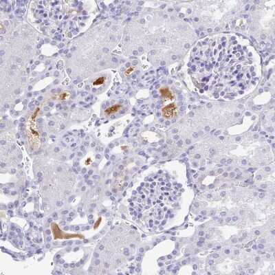 Immunohistochemistry-Paraffin: alpha 1B-Glycoprotein Antibody [NBP2-33419]