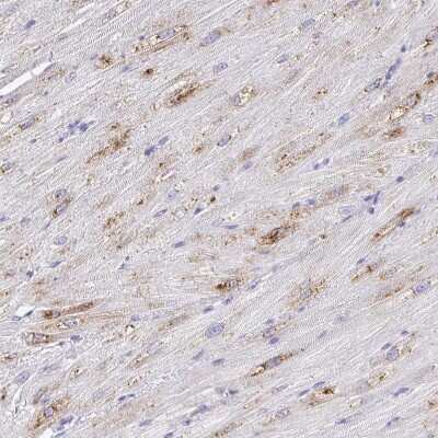 Immunohistochemistry-Paraffin: alpha 1B-Glycoprotein Antibody [NBP2-33419]
