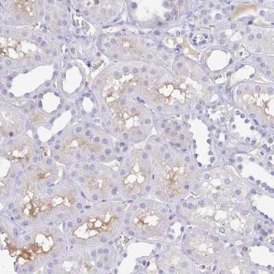 Immunohistochemistry-Paraffin: alpha 1B-Glycoprotein Antibody [NBP2-33419]