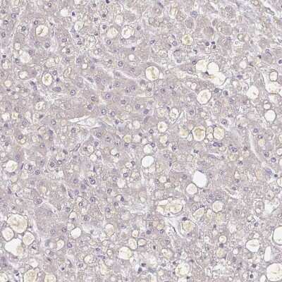 Immunohistochemistry-Paraffin: alpha 1B-Glycoprotein Antibody [NBP2-33419]