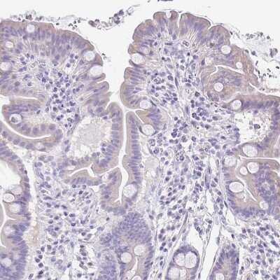 Immunohistochemistry-Paraffin: alpha 1B-Glycoprotein Antibody [NBP2-33419]