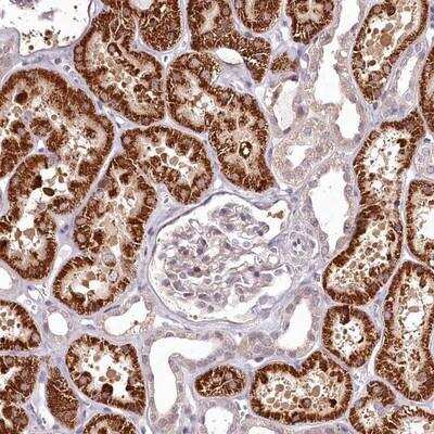 Immunohistochemistry: alpha-1D Adrenergic R/ADRA1D Antibody [NBP1-90229]