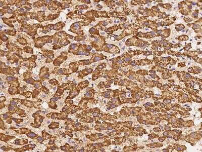 Immunohistochemistry-Paraffin: alpha-1D Adrenergic R/ADRA1D Antibody [NBP2-97580]