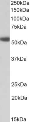 Western Blot: alpha-1D Adrenergic R/ADRA1D Antibody [NBP2-26183]