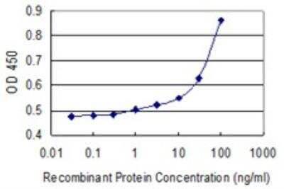 ELISA: alpha 2-Macroglobulin Antibody (2B5) [H00000002-M03]