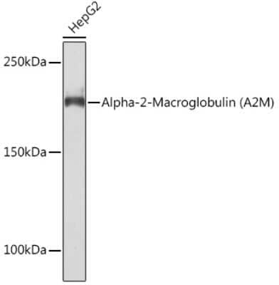 Western Blot: alpha 2-Macroglobulin Antibody (7V6M10) [NBP3-16875]