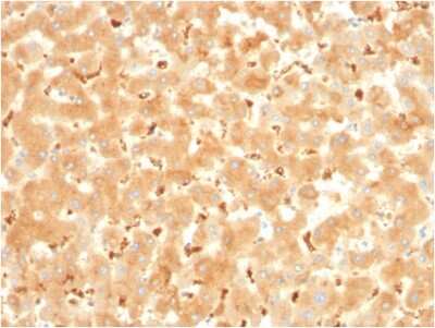 Immunohistochemistry-Paraffin: alpha 2-Macroglobulin Antibody (A2M/3621) - Azide and BSA Free [NBP3-08688]