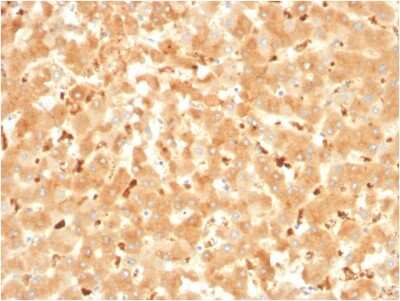 Immunohistochemistry-Paraffin: alpha 2-Macroglobulin Antibody (A2M/3621) [NBP3-07709]