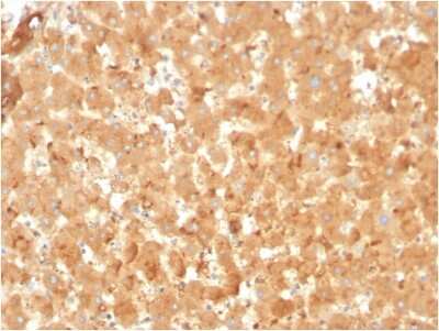 Immunohistochemistry-Paraffin: alpha 2-Macroglobulin Antibody (A2M/3623) [NBP3-07710]