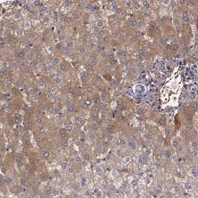 Immunohistochemistry-Paraffin: alpha 2-Macroglobulin Antibody [NBP1-85491]