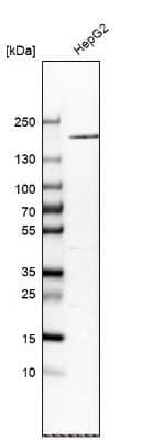 Western Blot: alpha 2-Macroglobulin Antibody [NBP1-85491]