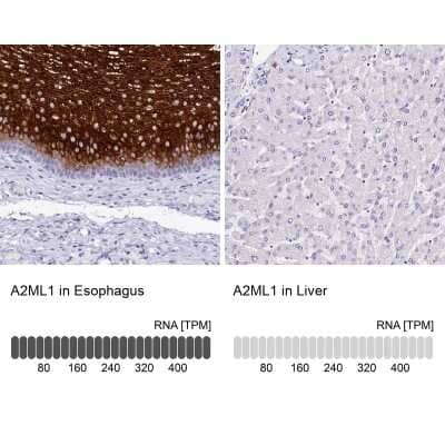 Immunohistochemistry-Paraffin: alpha 2-Macroglobulin-like 1/A2ML1 Antibody [NBP1-84392]