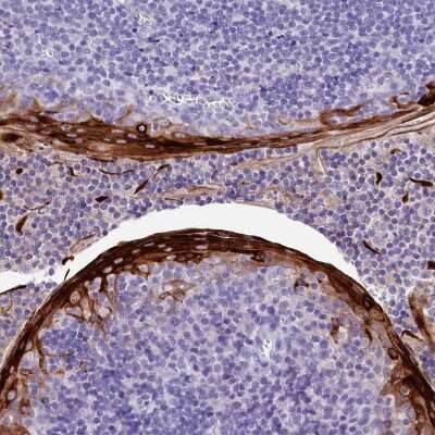 Immunohistochemistry-Paraffin: alpha 2-Macroglobulin-like 1/A2ML1 Antibody [NBP1-84392]