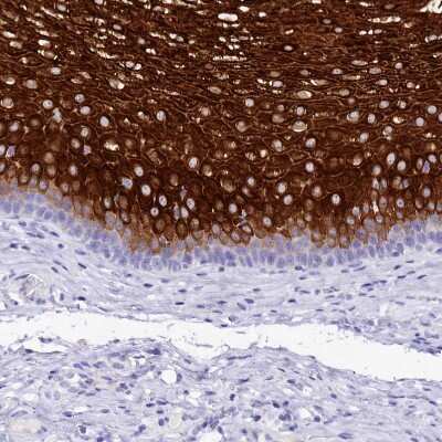 Immunohistochemistry-Paraffin: alpha 2-Macroglobulin-like 1/A2ML1 Antibody [NBP1-84392]