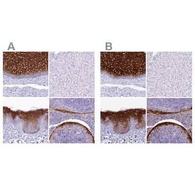 Immunohistochemistry-Paraffin: alpha 2-Macroglobulin-like 1/A2ML1 Antibody [NBP2-32647]
