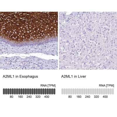 Immunohistochemistry-Paraffin: alpha 2-Macroglobulin-like 1/A2ML1 Antibody [NBP2-32647]