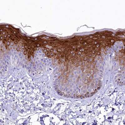 Immunohistochemistry-Paraffin: alpha 2-Macroglobulin-like 1/A2ML1 Antibody [NBP2-32647]