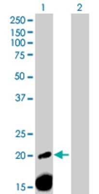 Western Blot: alpha 2-Macroglobulin-like 1/A2ML1 Antibody [H00144568-B01P]