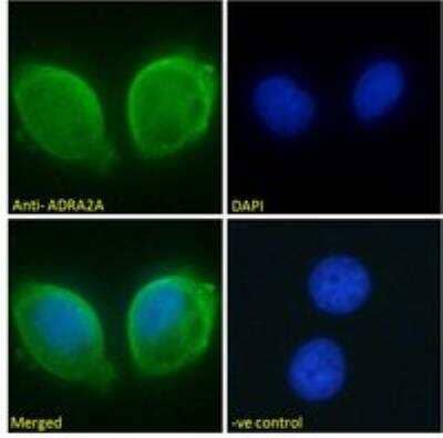 Immunocytochemistry/ Immunofluorescence: alpha-2A Adrenergic R/ADRA2A Antibody [NB100-2819]