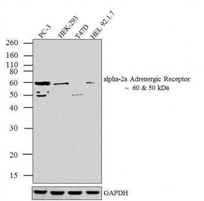 Western Blot: alpha-2A Adrenergic R/ADRA2A Antibody [NBP2-22452]