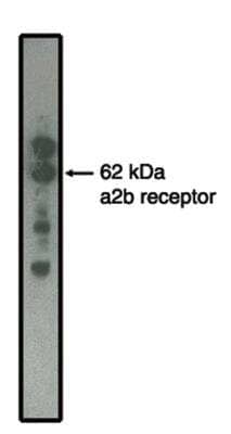 Western Blot: alpha-2B Adrenergic R/ADRA2B Antibody (5G10) [NBP2-66606]