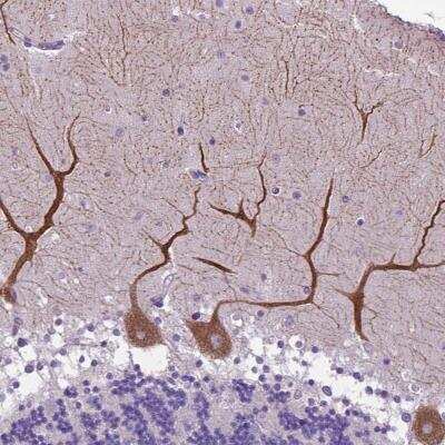 Immunohistochemistry-Paraffin: alpha-2B Adrenergic R/ADRA2B Antibody [NBP2-49470]