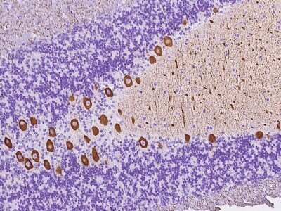 Immunohistochemistry-Paraffin: alpha-2B Adrenergic R/ADRA2B Antibody [NBP2-97424]