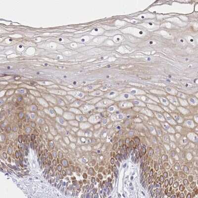 Immunohistochemistry-Paraffin: alpha-2C Adrenergic R/ADRA2C Antibody [NBP2-33845]